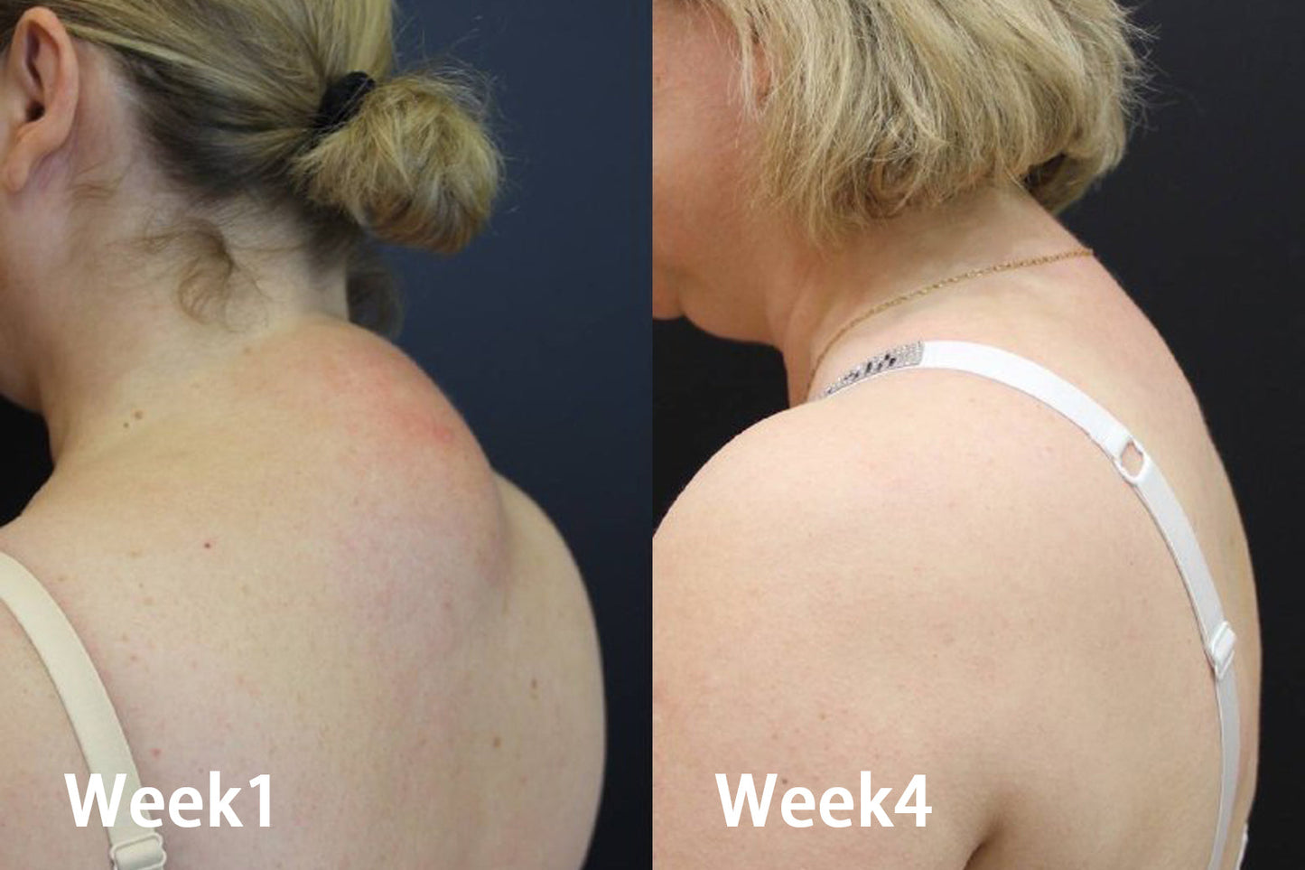 PURPLE JOINT PAIN RELIEF GEL.